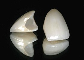 Porcelain-to-Zirconia